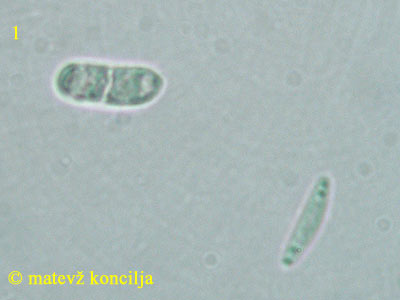 Lasiobelonium variegatum - Sporen