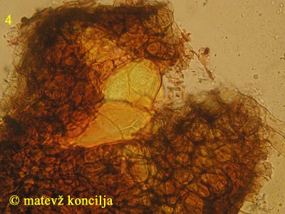 Phyllactinia guttata - cleistothecium