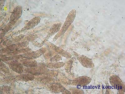 Thyronectria coryli - Asci mit Ascokonidien