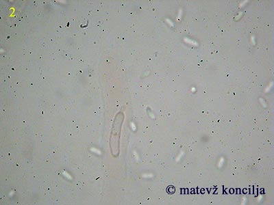 Thyronectria coryli - Ascus mit Ascosporen
