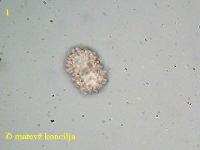 Dialonectria cosmariospora - spore