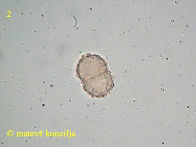 Dialonectria cosmariospora - spore