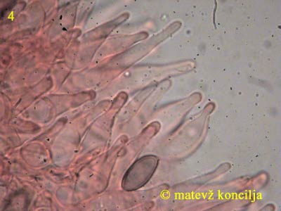 psilocybe cyanescens - pleurocistide