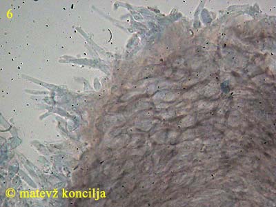 Dumontinia tuberosa - Excipulum