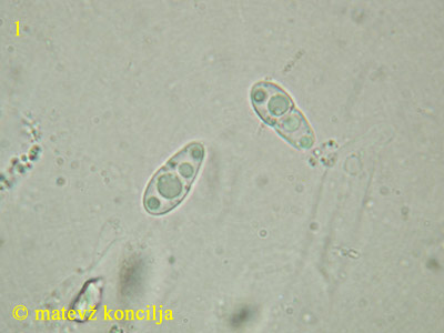 Sphaeria detrusa - Sporen