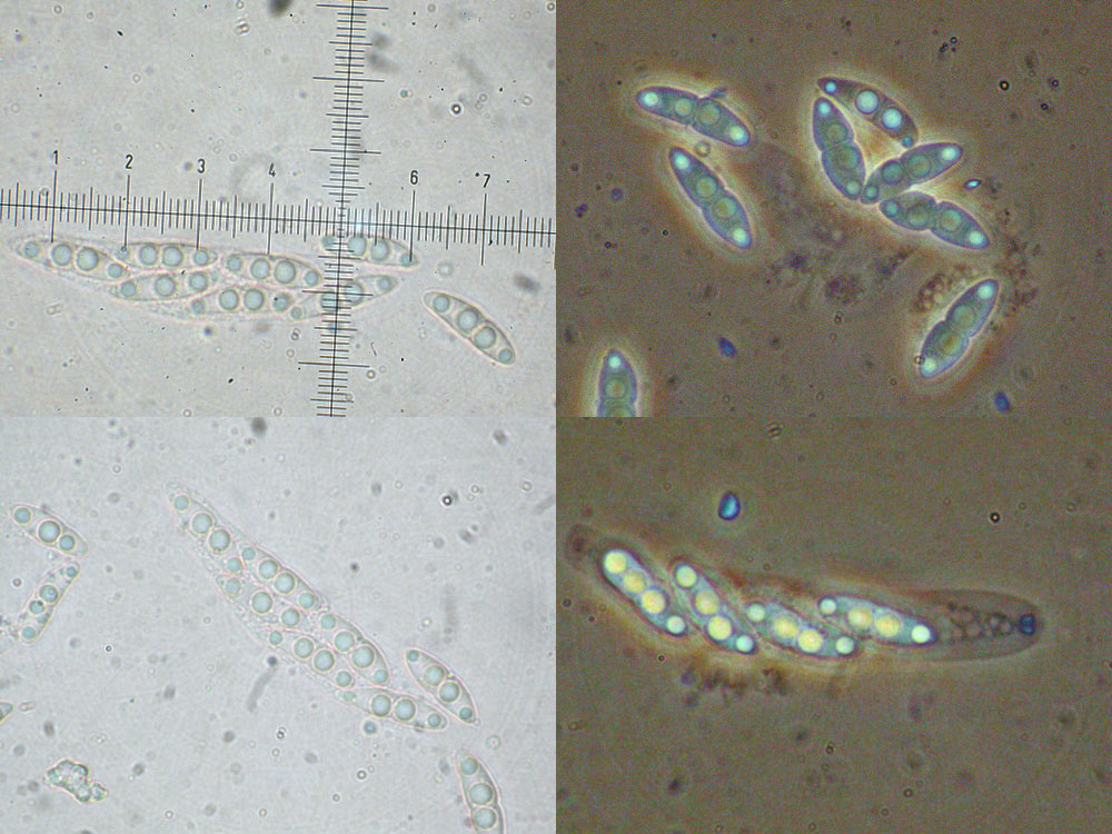 Diaporthe strumella