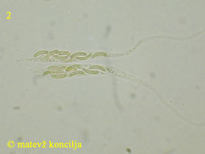 Diatrype disciformis - aski