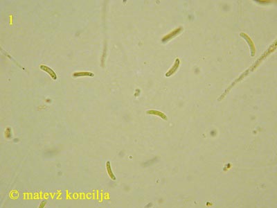 Diatrype disciformis - trosi