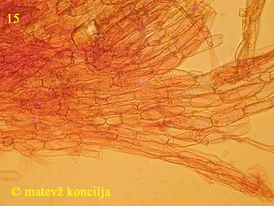 Inocybe dulcamara - hife koice klobuka