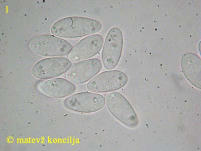 Dumontinia tuberosa - Sporen