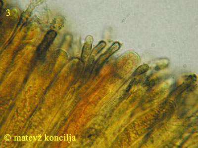 Encoelia fascicularis - Asci