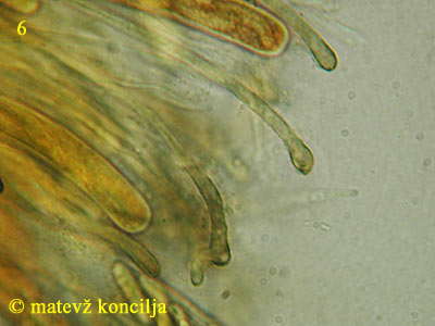 Encoelia fascicularis - Paraphysen