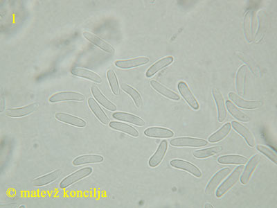 Encoelia fascicularis - Sporen