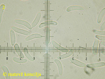 Encoelia fascicularis - Sporen