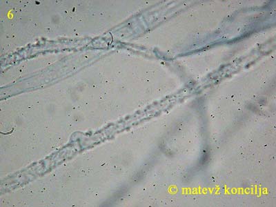 athelia epiphylla agg. - hife