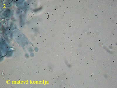 Athelia epiphylla agg. - Basidie
