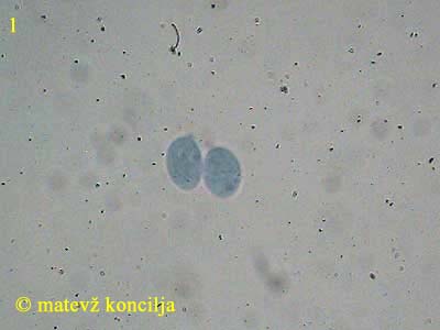 athelia epiphylla agg. - trosi