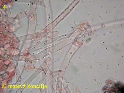 athelia epiphylla agg. - hife