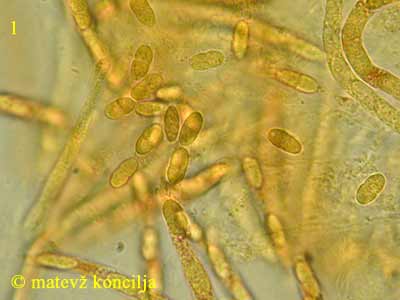 Nectria episphaeria - Sporen