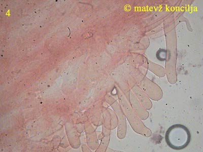 inocybe erubescens - kaulocistide