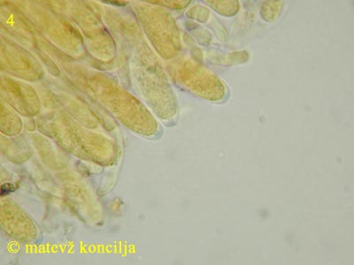 Ascotremella faginea - Asci