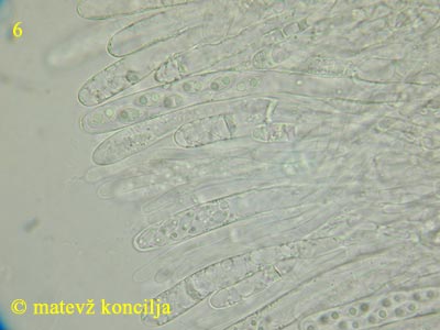 Ascotremella faginea - Asci