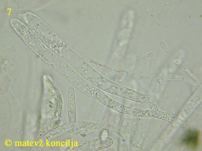 Ascotremella faginea - Asci