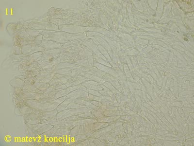 Ascotremella faginea - excipulum