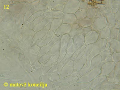 Ascotremella faginea - Excipulum