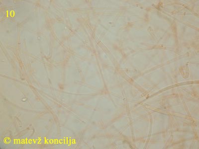 Ascotremella faginea - Medulla-Hyphen