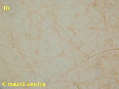 Ascotremella faginea - medulla