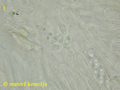 Ascotremella faginea - Sporen