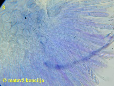 Ascotremella faginea - subhymenium