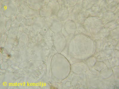 Ascotremella faginea - Subhymenium