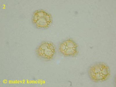 Trichia favoginea - Sporen