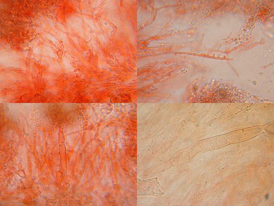 Flammulina elastica - Hutdeckschicht