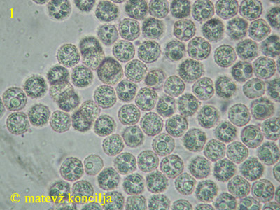 Lycogala flavofuscum - Sporen