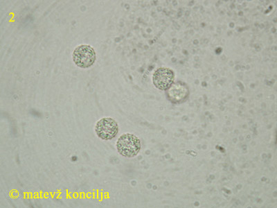 Lycogala flavofuscum - trosi