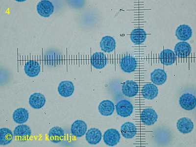 Lycogala flavofuscum - Sporen