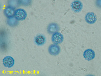 Lycogala flavofuscum - Sporen