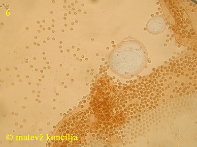 Lycogala flavofuscum - Sporen