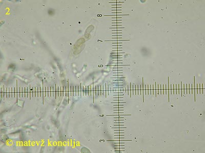Eutypa flavovirens - Ascus