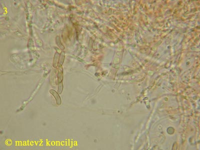 Eutypa flavovirens - Ascus