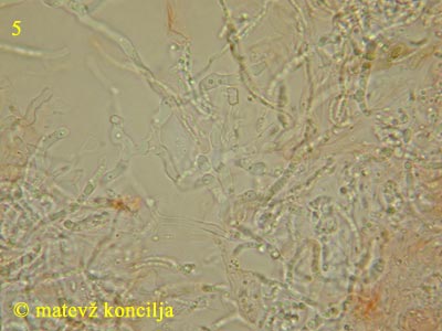 Eutypa flavovirens - Hyphen