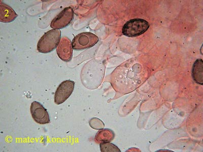 Panaeolina foenisecii - Basidie und Cheilozystiden