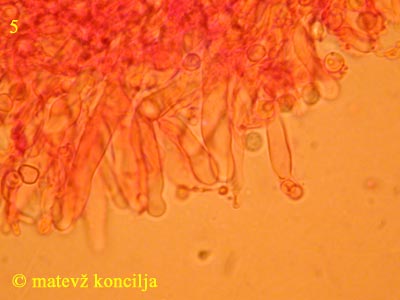 Dentipellis fragilis - Gloeozystiden