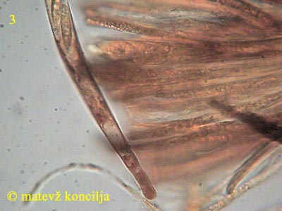 Hymenoscyphus fructigenus - Ascus