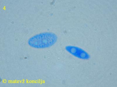 Nectria fuckeliana - Sporen