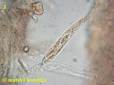 tapesia fusca - ask