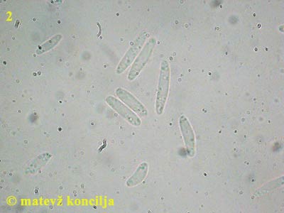 Mollisia fusca - Sporen